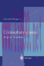 [PDF]Craniopharyngioma: Surgical Treatment
