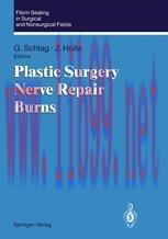 [PDF]Fibrin Sealing in Surgical and Nonsurgical Fields: Volume 3: Plastic Surgery Nerve Repair Burns