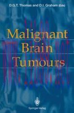 [PDF]Malignant Brain Tumours
