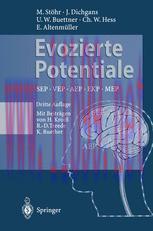 [PDF]Evozierte Potentiale: SEP-VEP-AEP-EKP-MEP
