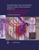 [PDF]Neurosurgery of Arteriovenous Malformations and Fistulas: A Multimodal Approach