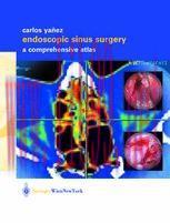 [PDF]Endoscopic Sinus Surgery: A Comprehensive Atlas