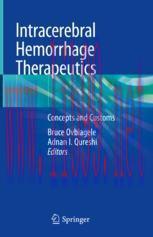 [PDF]Intracerebral Hemorrhage Therapeutics: Concepts and Customs