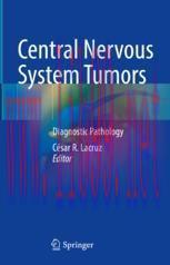 [PDF]Central Nervous System Tumors: Diagnostic Pathology