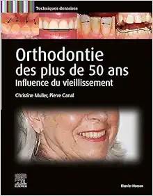 [AME]Orthodontie des plus de 50 ans: Influence du vieillissement (True PDF From_ Publisher) 