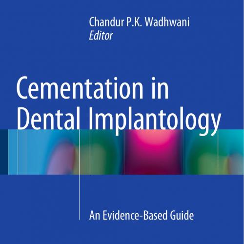 Cementation in Dental Implantology An Evidence-Based Guide (2015)