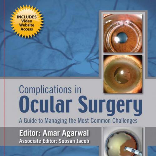 Complications in Ocular Surgery A Guide to Managing the Most Common Challenges