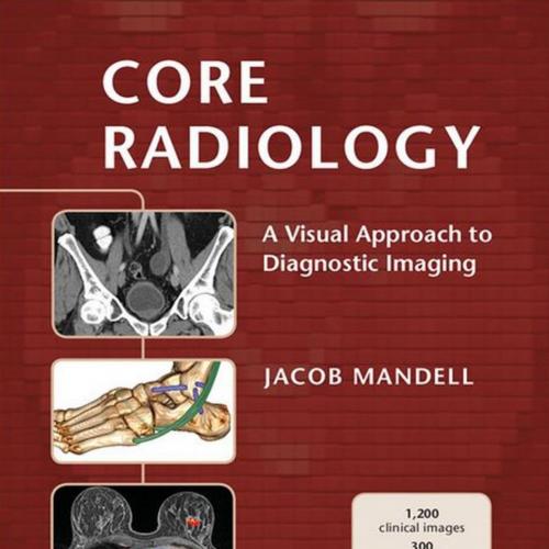 Core Radiology A Visual Approach to Diagnostic Imaging - Jacob Mandell