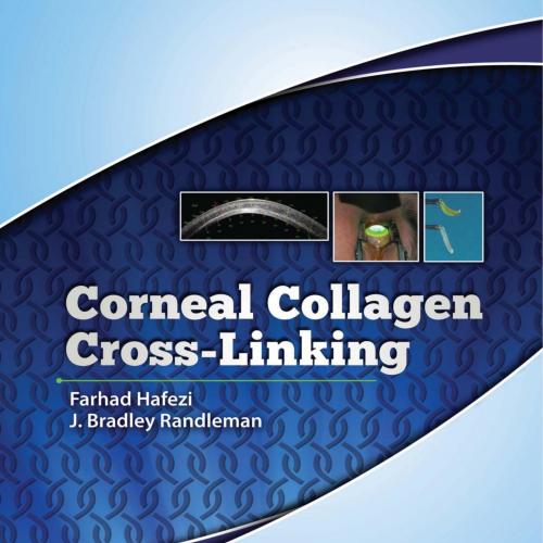 Corneal Collagen Cross-Linking