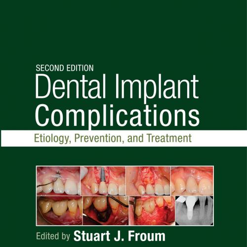Dental Implant Complications Etiology, Prevention, and Treatment, 2nd Edition