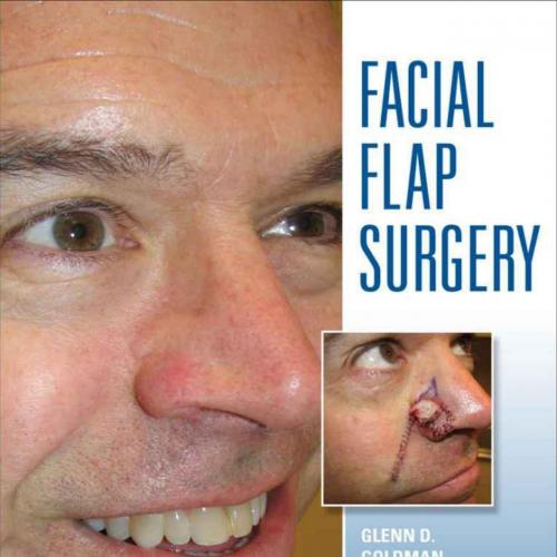 Facial Flaps Surgery - Goldman, Glenn & Dzubow, Leonard