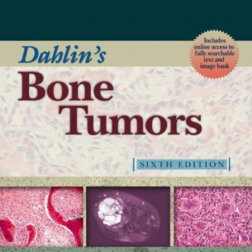 Dahlin's Bone Tumors General Aspects and Data on 10,165 Cases, 6th Edition