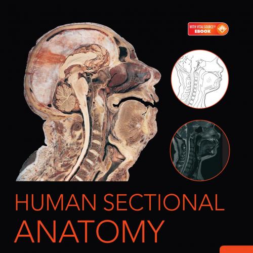 Human Sectional Anatomy Atlas of Body Sections, CT and MRI Images, 4th Edition