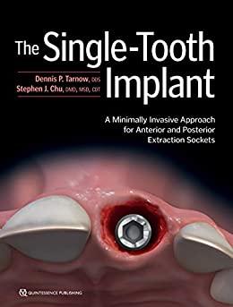 [PDF]The Single-Tooth Implant A Minimally Invasive Approach for Anterior and Posterior Extraction Sockets