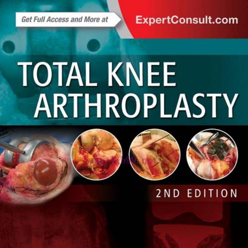 Total Knee Arthroplasty,2nd Edition