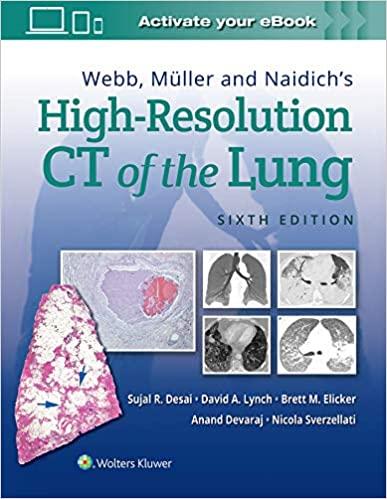 [Html][Ebook]Webb, Müller and Naidich’s High-Resolution CT of the Lung 6th edition