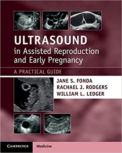 [PDF][Ebook]Ultrasound in Assisted Reproduction and Early Pregnancy